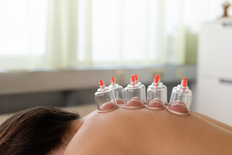 Schröpfen - Schröpfmassage in Rankweil, Vorarlberg durch Sabine Böhler von Körperkultur